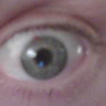 After Lasik. 48 hours postop.